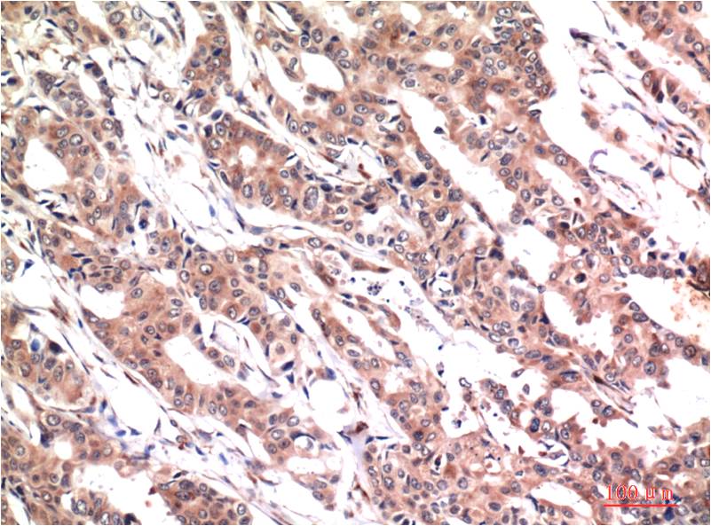 Phospho-STAT3 (Tyr705) (5E9) Mouse mAb ABZ4413