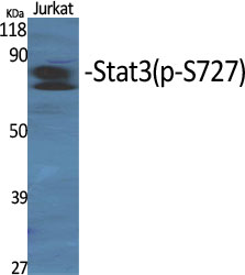 Phospho-STAT3 (Ser727) Rabbit pAb ABZ4414
