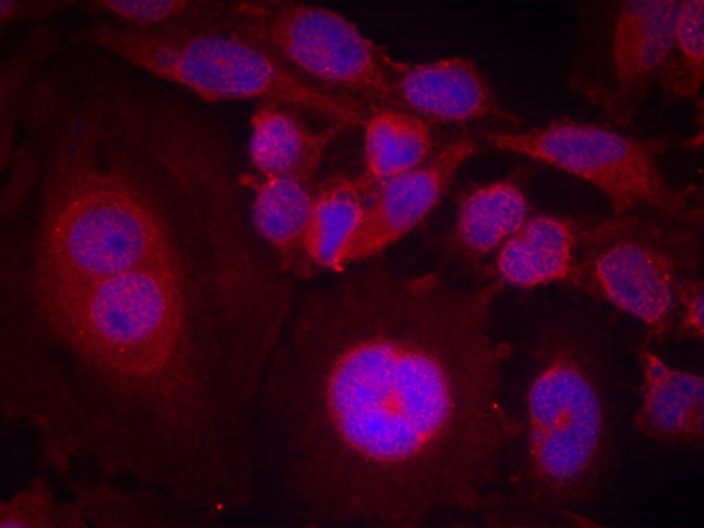 Phospho-STAT3 (Ser727) Rabbit pAb ABZ4417