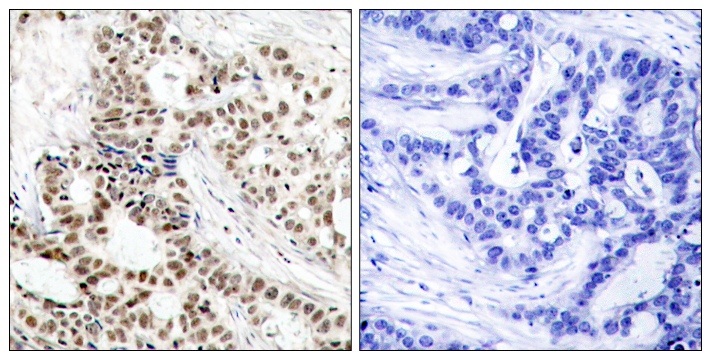 Phospho-BRCA1 (Ser1423) Rabbit pAb ABZ4418