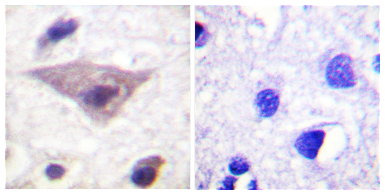 Phospho-alpha Synuclein (Ser129) Rabbit pAb ABZ4419