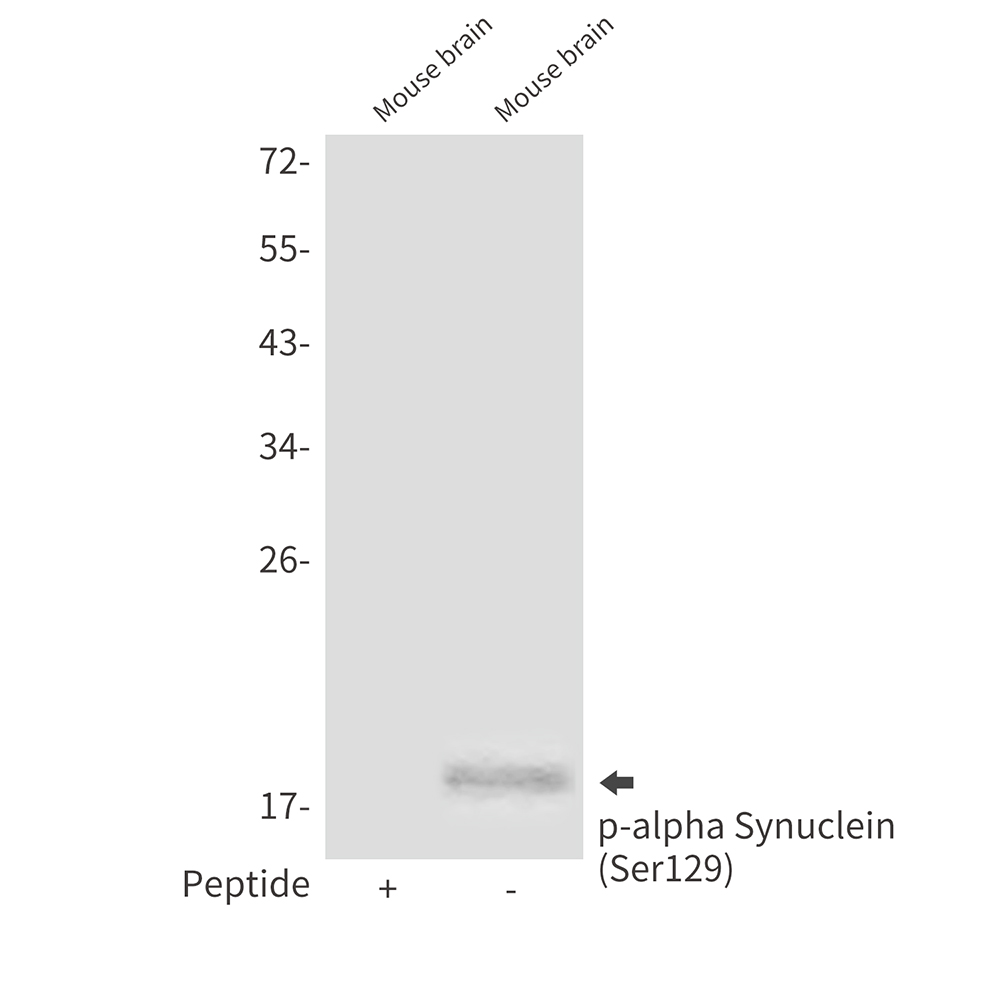 Phospho-alpha Synuclein (Ser129) Rabbit pAb ABZ4419