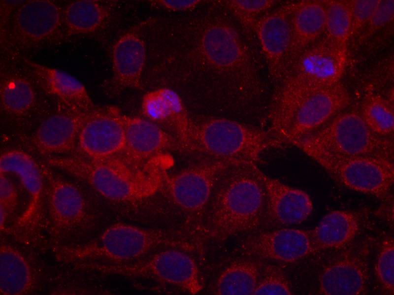 Phospho-VEGF Receptor 2 (Tyr1175) Rabbit pAb ABZ4421