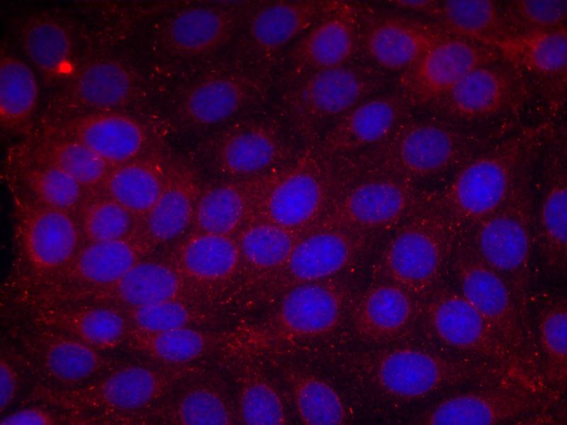 Phospho-VEGF Receptor 2 (Tyr1214) Rabbit pAb ABZ4422