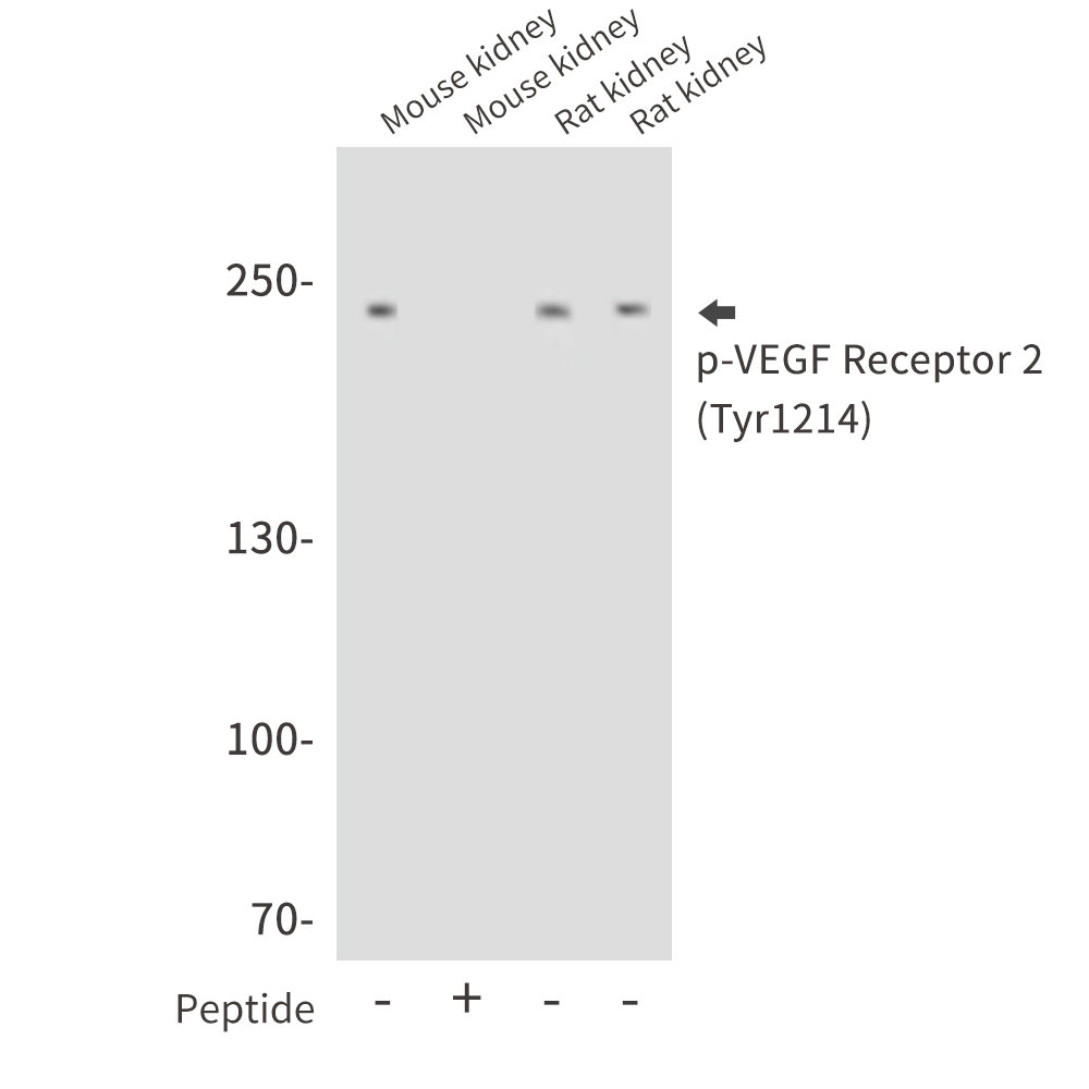 Phospho-VEGF Receptor 2 (Tyr1214) Rabbit pAb ABZ4422