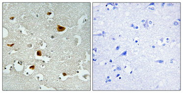 Phospho-IRS1 (Ser636) Rabbit pAb ABZ4423