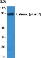 Phospho-beta Catenin (Ser37) Rabbit pAb ABZ4425
