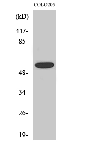 Phospho-AKT1/2/3 (Thr308) Rabbit pAb ABZ4430