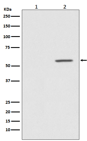 Phospho-AKT1 (Ser124) Rabbit mAb ABZ4431