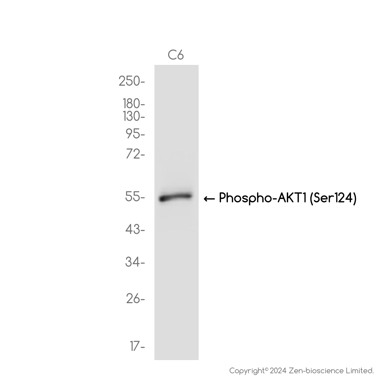 Phospho-AKT1 (Ser124) Rabbit mAb ABZ4431