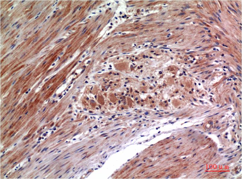 Phospho-ERK1/2 (Tyr222/Tyr205) (1H4) Mouse mAb ABZ4432