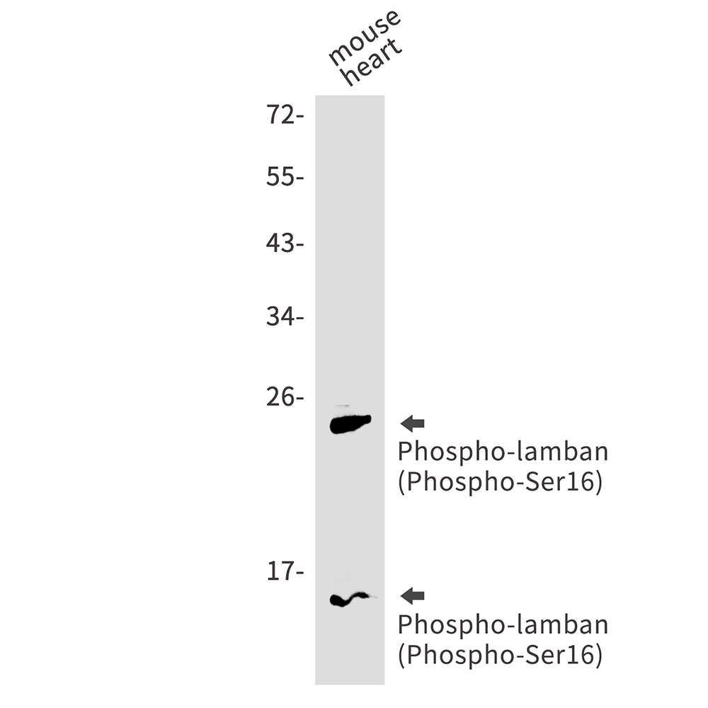 Phospho-Phospholamban (Ser16) Rabbit mAb ABZ4436