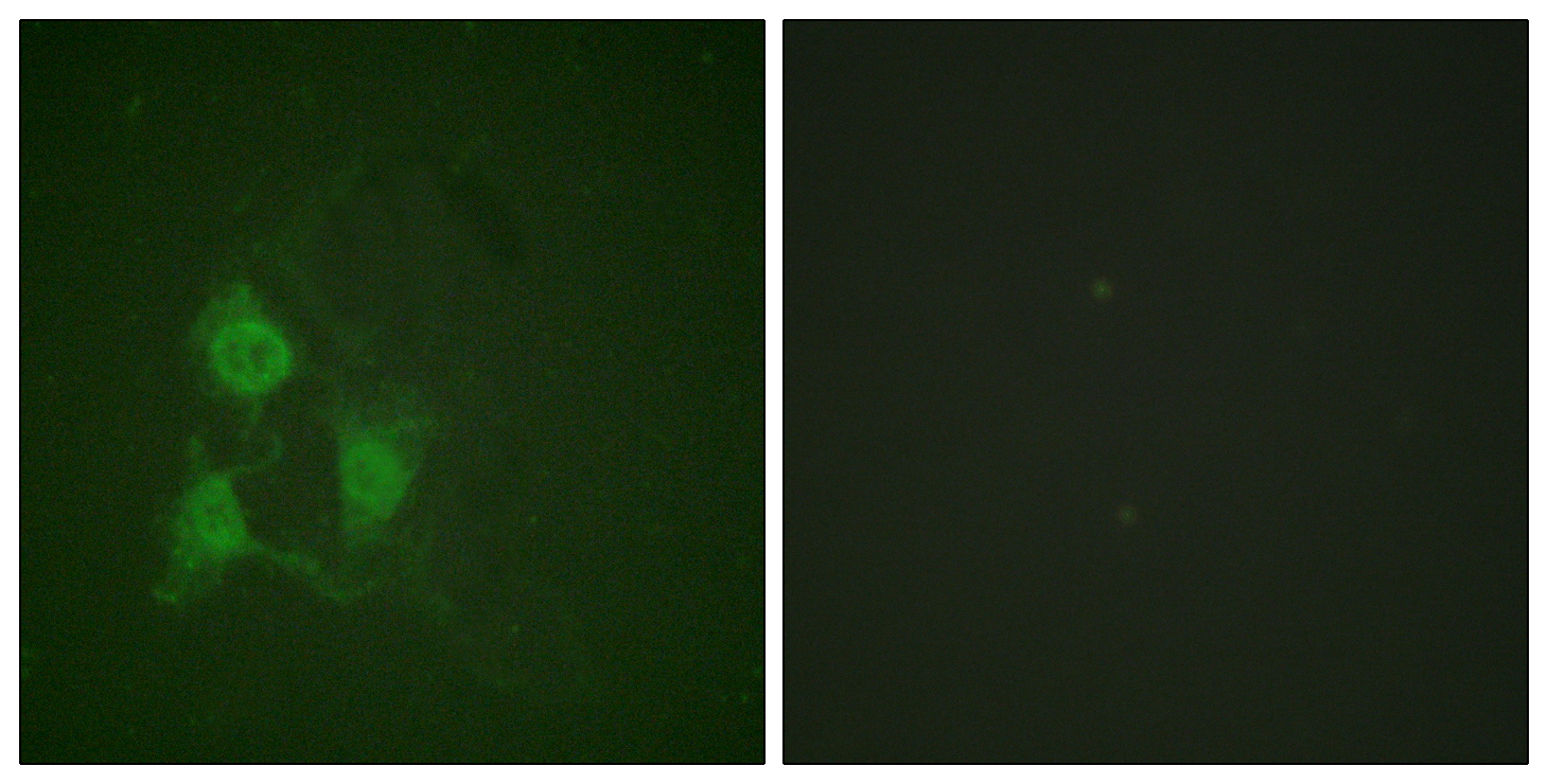 Phospho-PKA alpha/beta/gamma (Thr197) Rabbit pAb ABZ4440