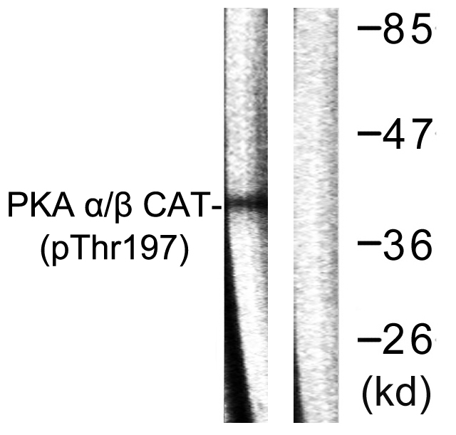Phospho-PKA alpha/beta/gamma (Thr197) Rabbit pAb ABZ4440