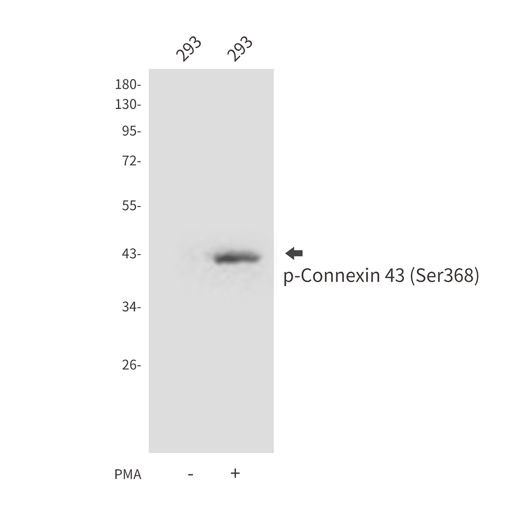 Phospho-Connexin 43 / GJA1 (Ser368) Rabbit pAb ABZ4441