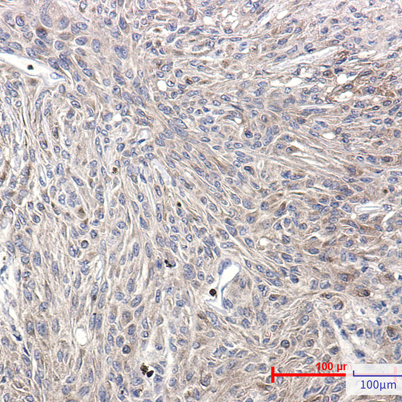 Phospho-PKC (Ser660) Rabbit mAb ABZ4442