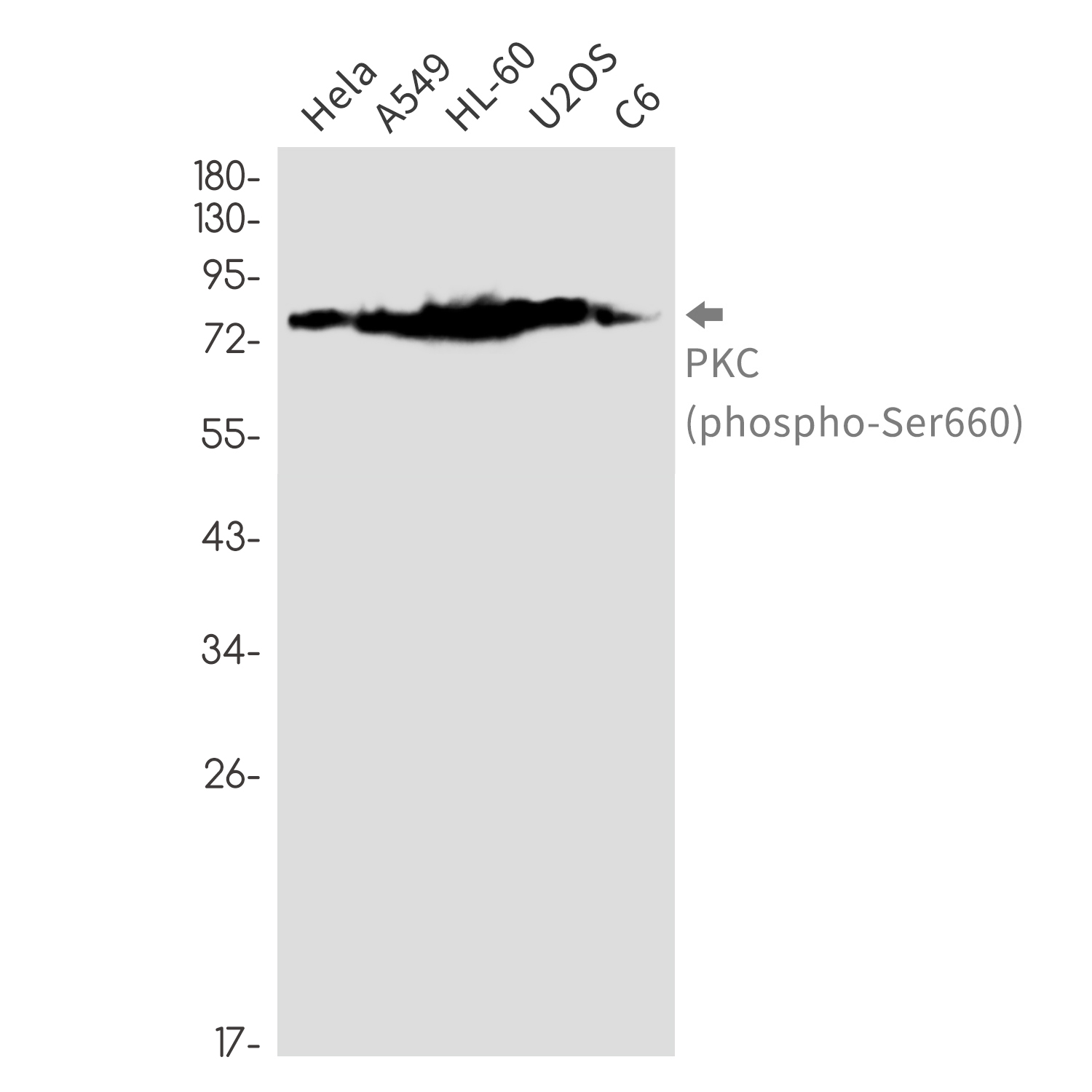 Phospho-PKC (Ser660) Rabbit mAb ABZ4442