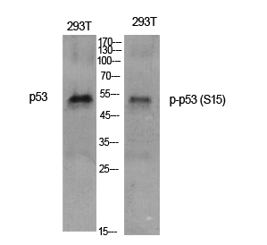 Phospho-p53 (Ser15) Rabbit pAb ABZ4443
