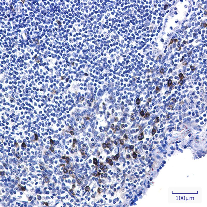 Phospho-p53 (Ser6) Rabbit mAb ABZ4444