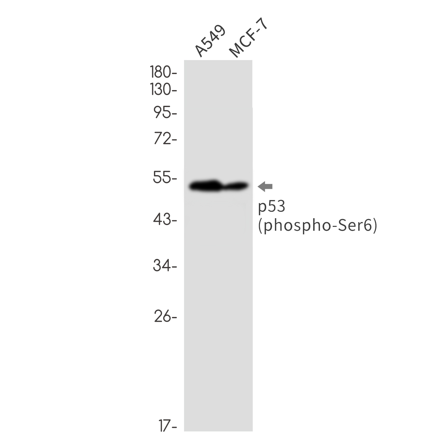 Phospho-p53 (Ser6) Rabbit mAb ABZ4444