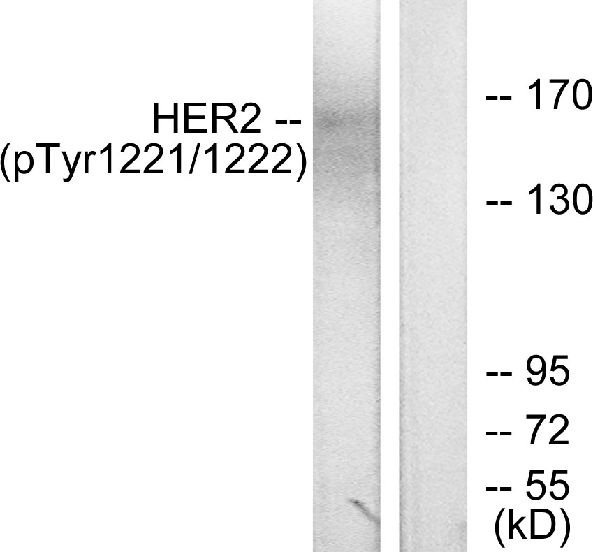 Phospho-HER2 (Tyr1221/Tyr1222) Rabbit pAb ABZ4445