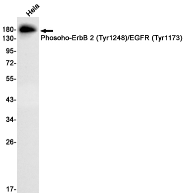 Phosoho-HER2 (Tyr1248/Tyr1173) Rabbit mAb ABZ4446
