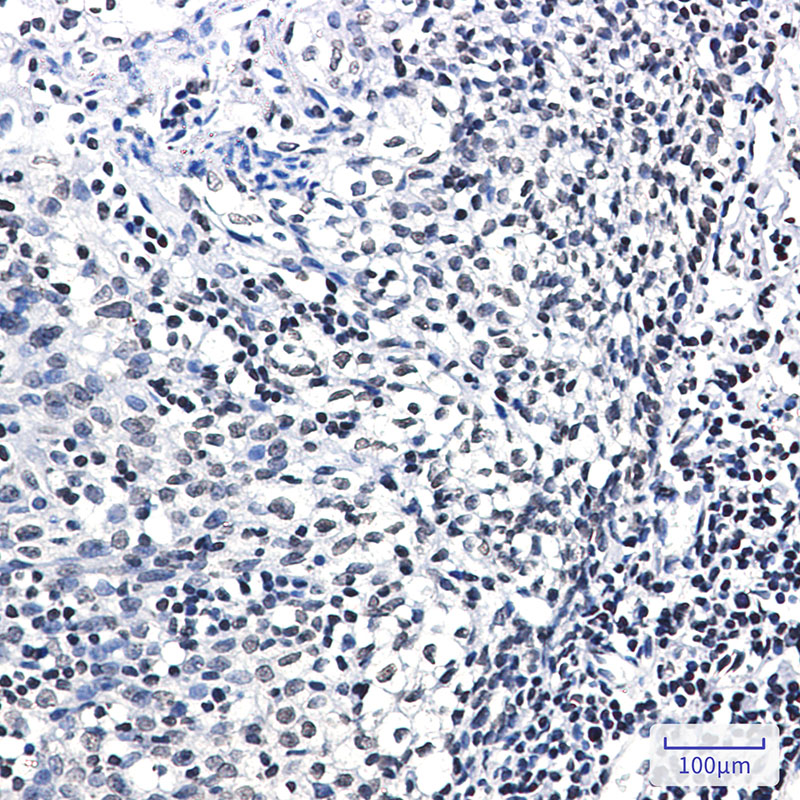 Phospho-Glucocorticoid Receptor (Ser226) Rabbit mAb ABZ4447