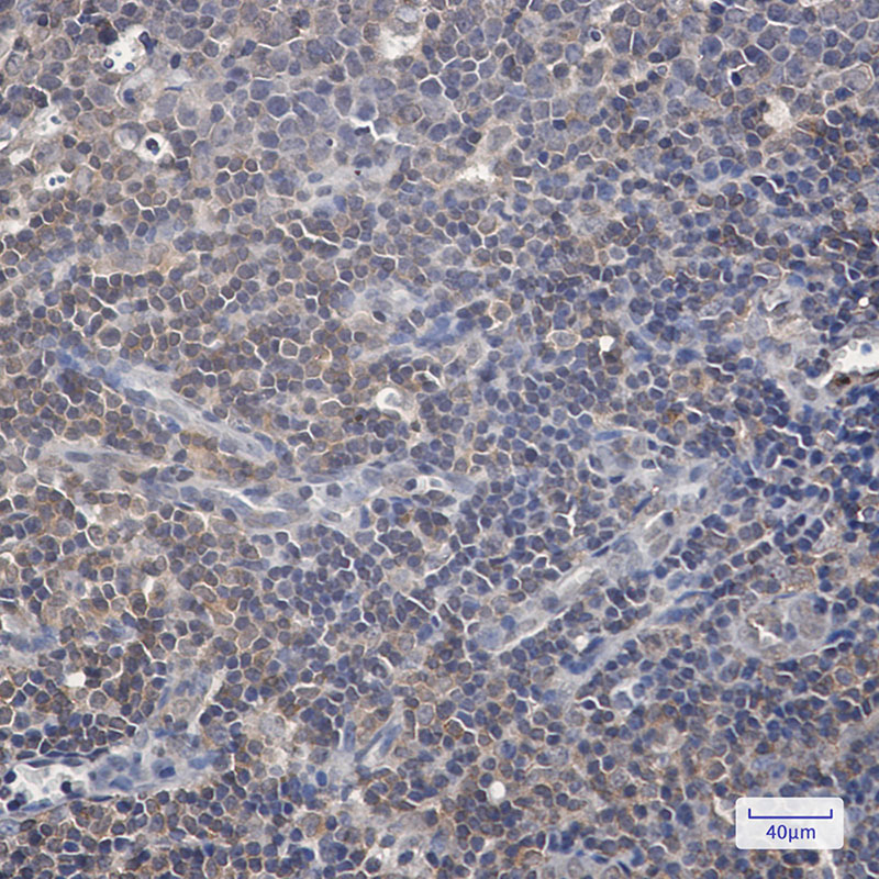 Phospho-Raf1 (Ser259) Rabbit mAb ABZ4448