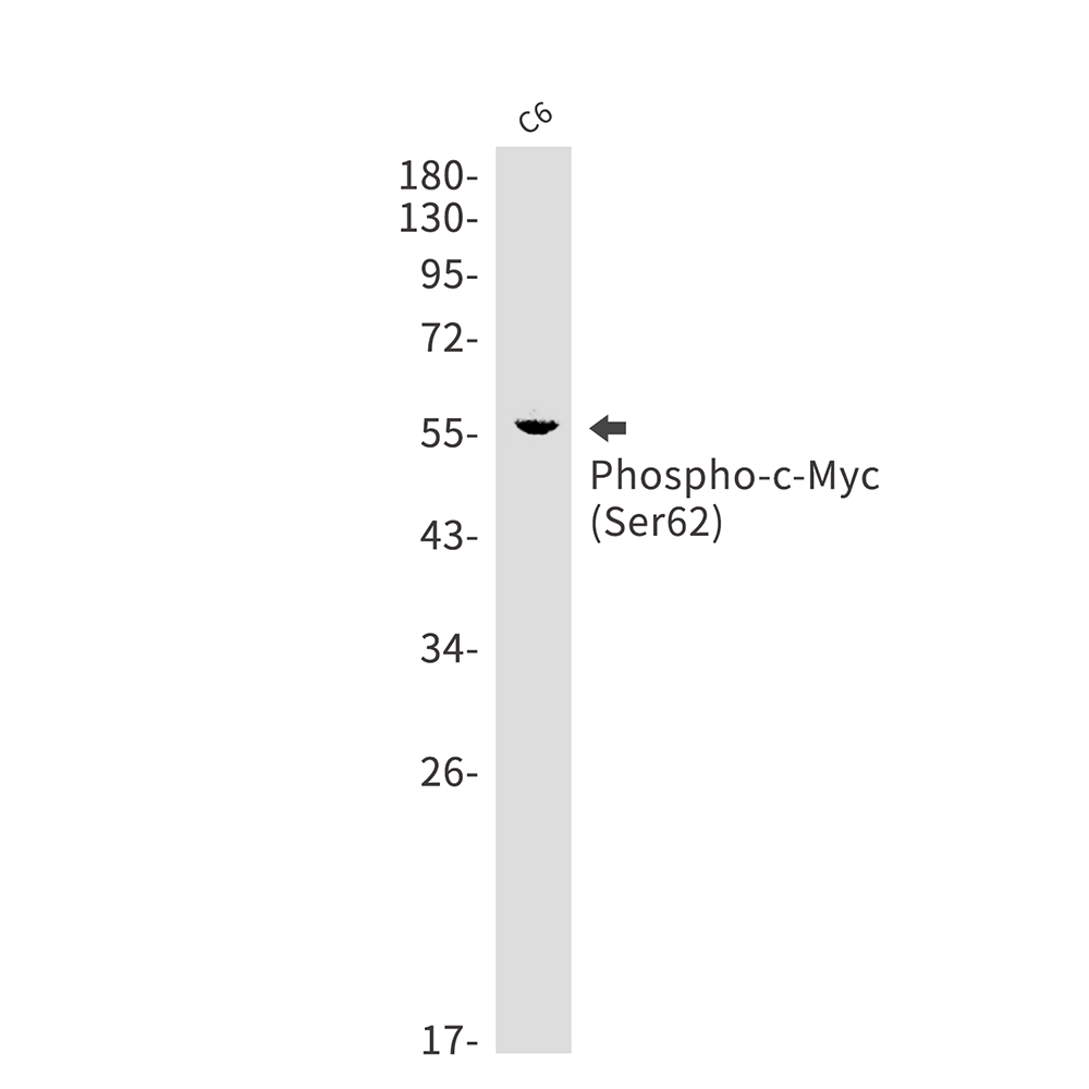 Phospho-c-Myc (Ser62) Rabbit mAb ABZ4449