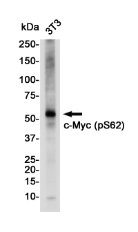Phospho-c-Myc (Ser62) Rabbit mAb ABZ4449