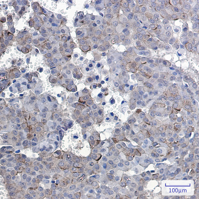Phospho-EGFR (Tyr1092) Rabbit mAb ABZ4451