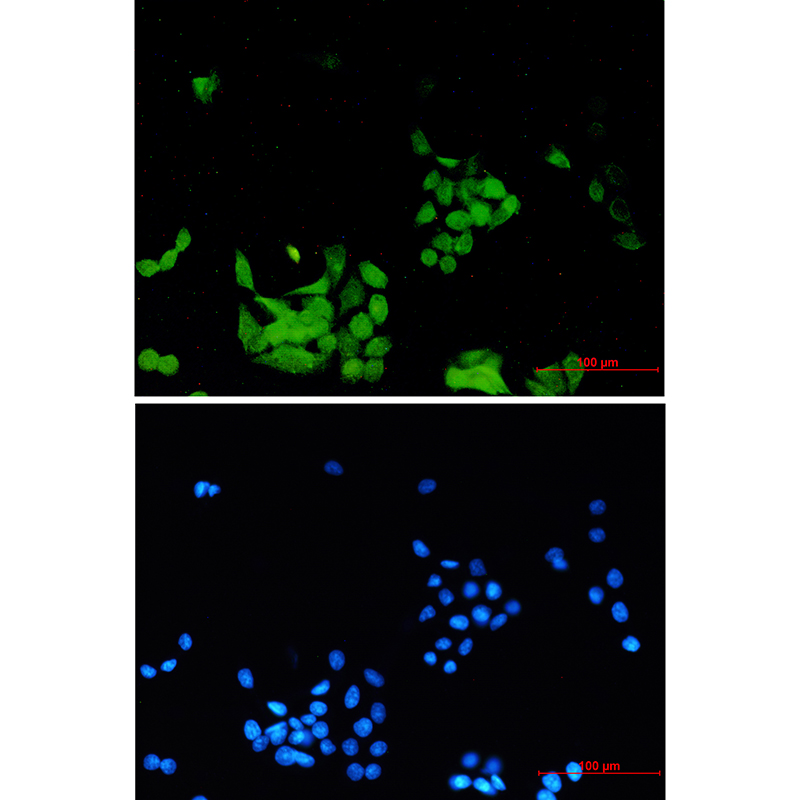 Phospho-EGFR (Tyr1173) Rabbit mAb ABZ4452