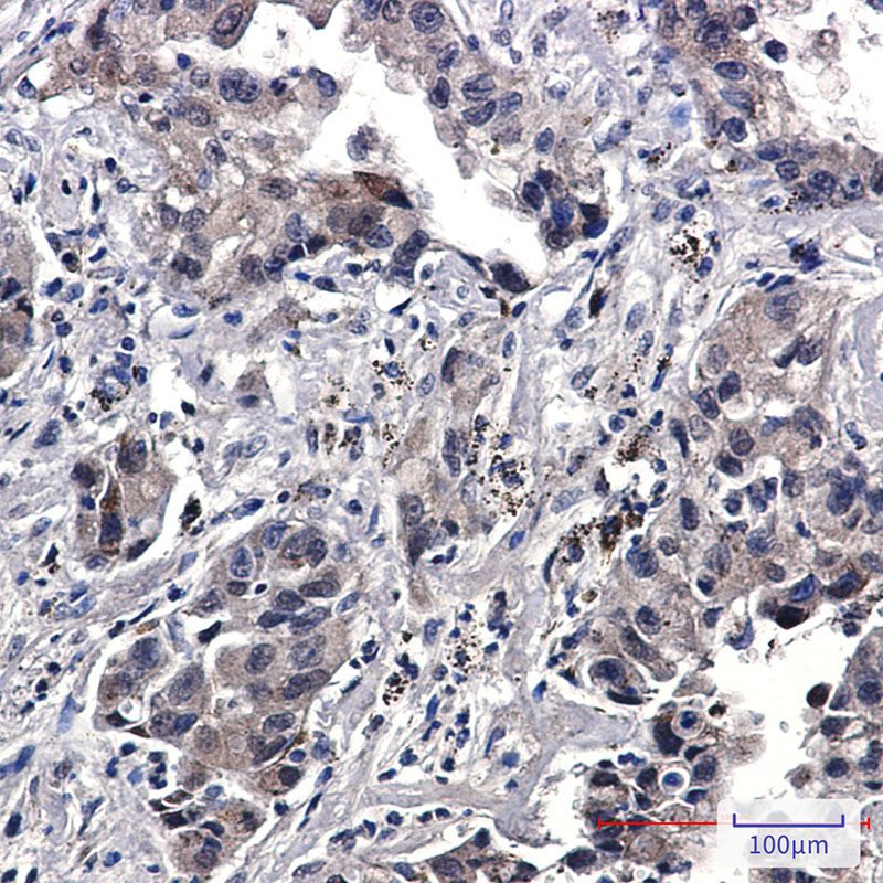 Phospho-EGFR (Tyr1173) Rabbit mAb ABZ4452