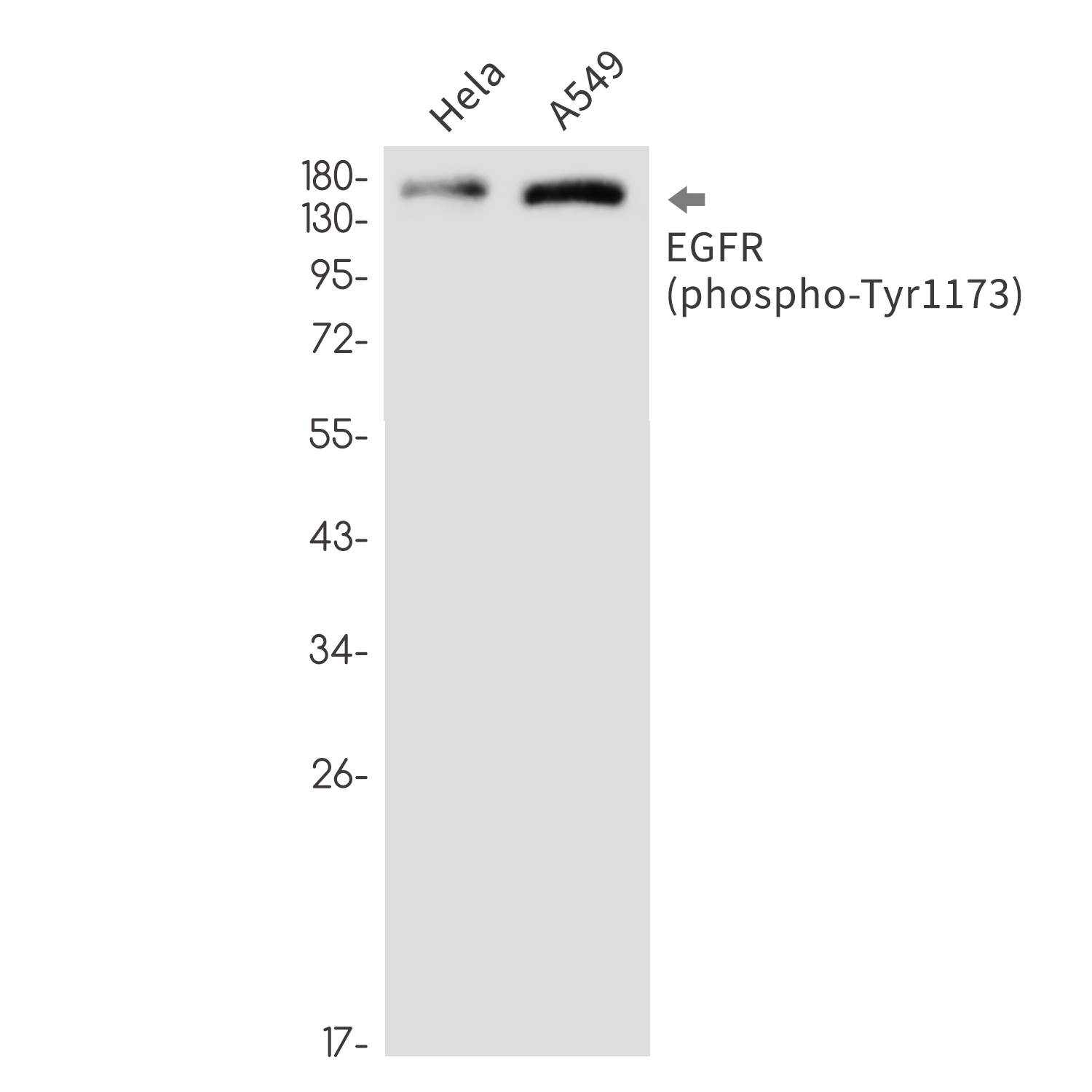 Phospho-EGFR (Tyr1173) Rabbit mAb ABZ4452