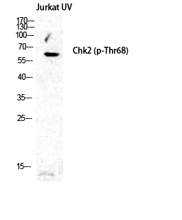 Phospho-Chk2 (Thr68) Rabbit pAb ABZ4453