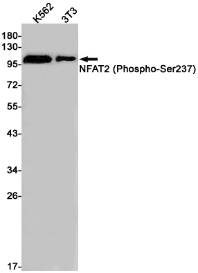 Phospho-NFAT2 (Ser237) Rabbit mAb ABZ4454