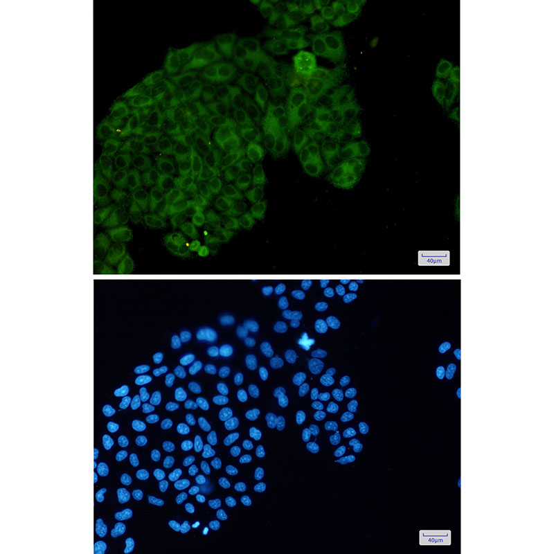 Phospho-PAK1/2/3 (Ser144/Ser141/Ser154) Rabbit mAb ABZ4455