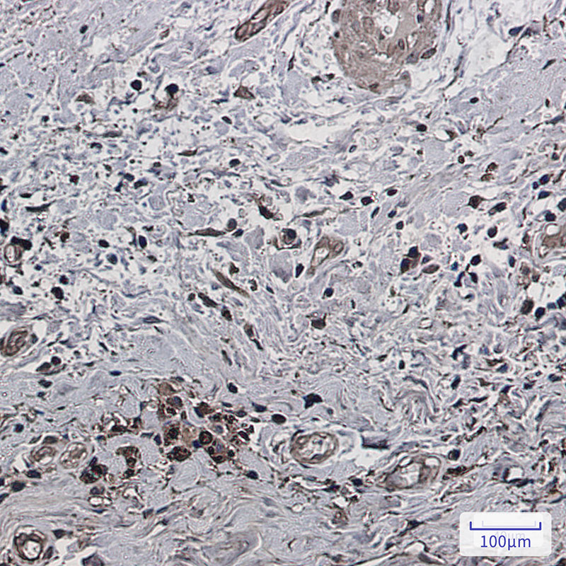 Phospho-PAK1/2/3 (Ser144/Ser141/Ser154) Rabbit mAb ABZ4455