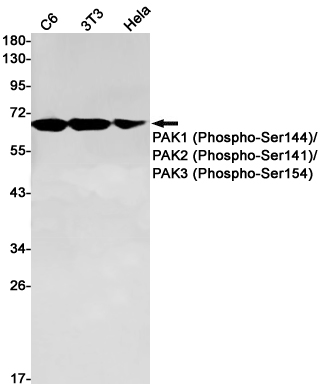 Phospho-PAK1/2/3 (Ser144/Ser141/Ser154) Rabbit mAb ABZ4455