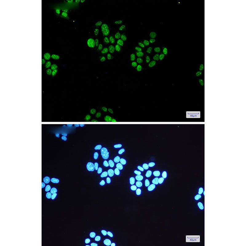 Phospho-MSK1 (Ser360) Rabbit mAb ABZ4456