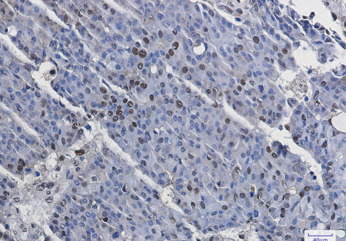 Phospho-MSK1 (Ser376) Rabbit mAb ABZ4457