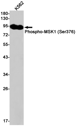 Phospho-MSK1 (Ser376) Rabbit mAb ABZ4457
