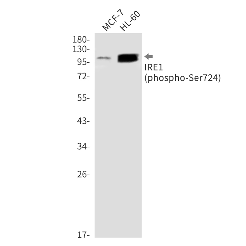 Phospho-IRE1 (Ser724) Rabbit mAb ABZ4459
