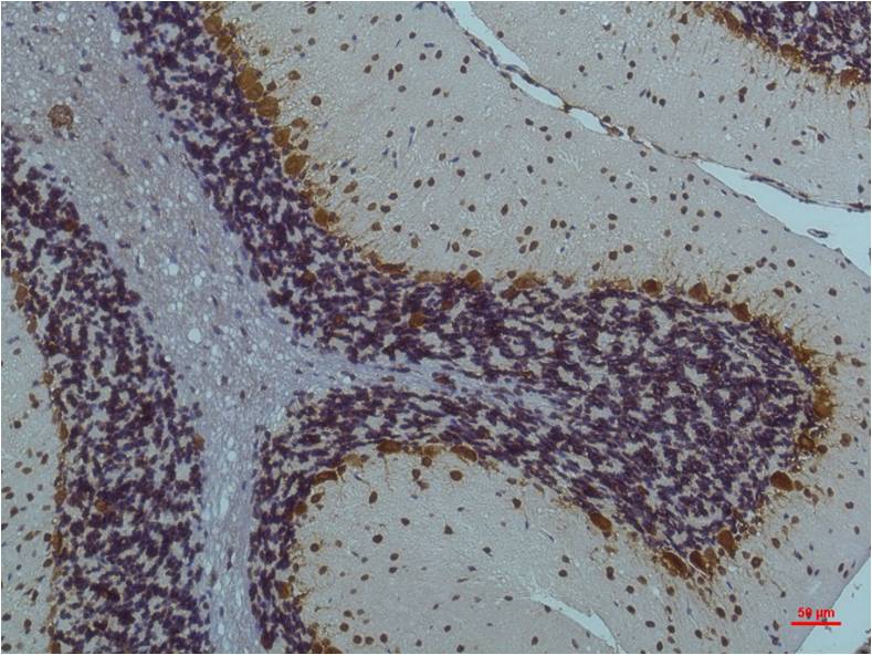 Phospho-CaMKII (Thr287) (4A8) Mouse mAb ABZ4466