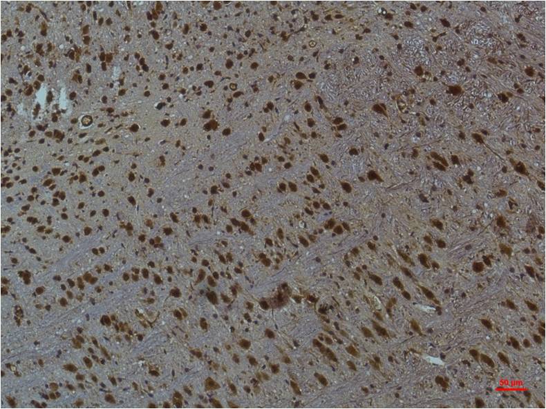 Phospho-CaMKII (Thr287) (4A8) Mouse mAb ABZ4466
