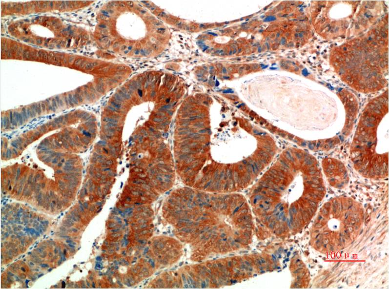 Phospho-ERK1/2 (Tyr222/Tyr205) (10C8) Mouse mAb ABZ4467