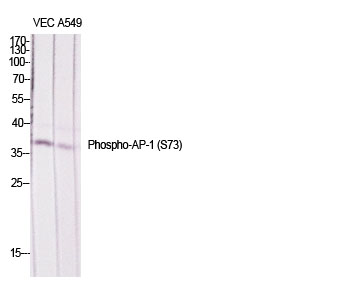 Phospho-c-Jun/JunD (Ser73/100) Rabbit pAb ABZ4468