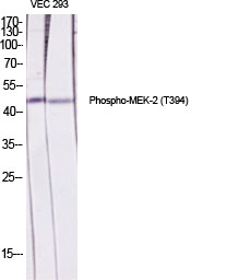 Phospho-MEK2 (Thr394) Rabbit pAb ABZ4470