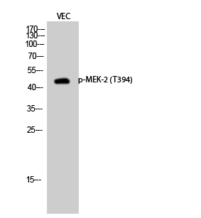 Phospho-MEK2 (Thr394) Rabbit pAb ABZ4470
