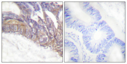 Phospho-LAT (Tyr191) Rabbit pAb ABZ4473